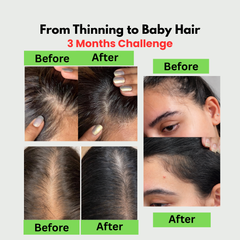 Wonder Hair Growth Oil + Rosemary Essential Oil - The Nature's Pick